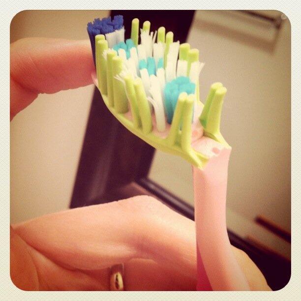 Toothbrush Torticollis